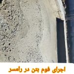 فوم بتن لیزری حسینی